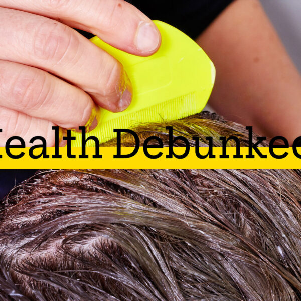 How Much Is Lice Treatment? A Comprehensive Guide…